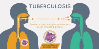 Covid-19: TB treatment, coverage dropped to 27 per cent in 2021 – Stakeholders